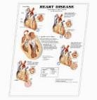 3D ANATOMICAL CHART HEART DISEASE