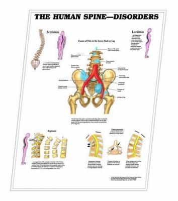 3D ANATOMICAL CHART THE HUMAN SPINE - DISORDERS
